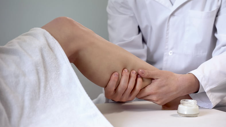 VARICES