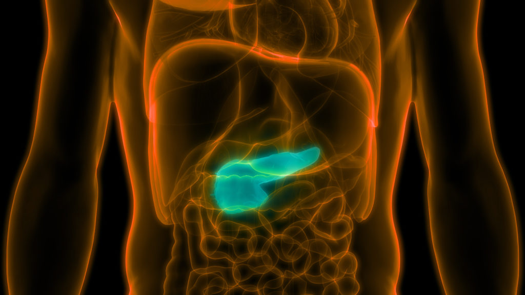 cáncer de páncreas