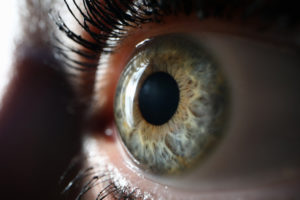 glaucoma