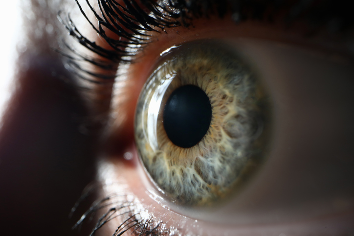 glaucoma