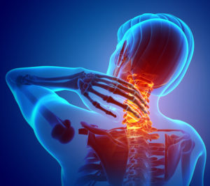 dolor cervical