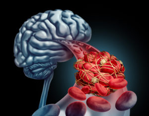 cerebro