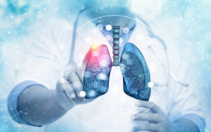 cáncer de pulmón