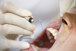 dental