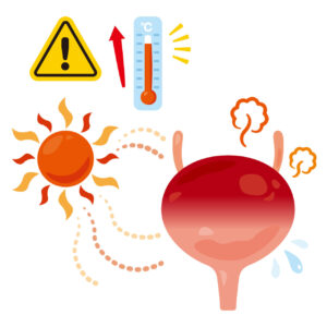 verano y urología