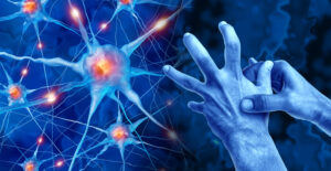 Ilustración de neuronas y manos con síntomas de Parkinson