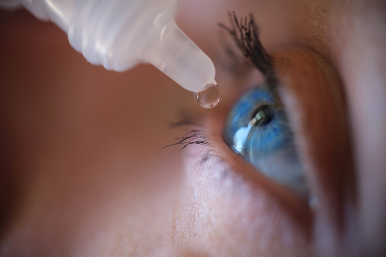 ojos