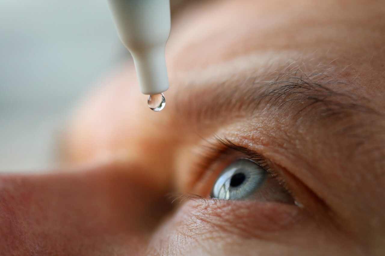 Aplicación de lágrimas artificiales en un ojo seco