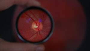 retina