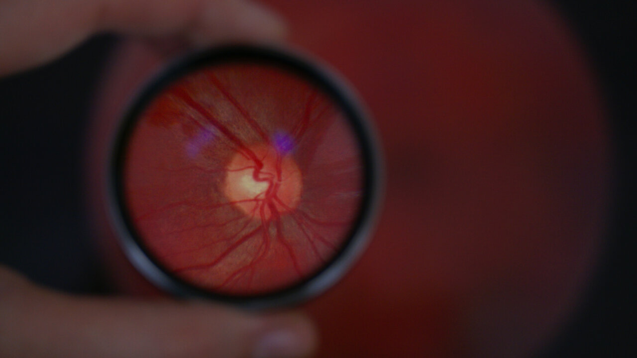 retina