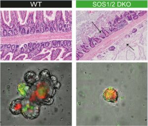 barrera intestinal