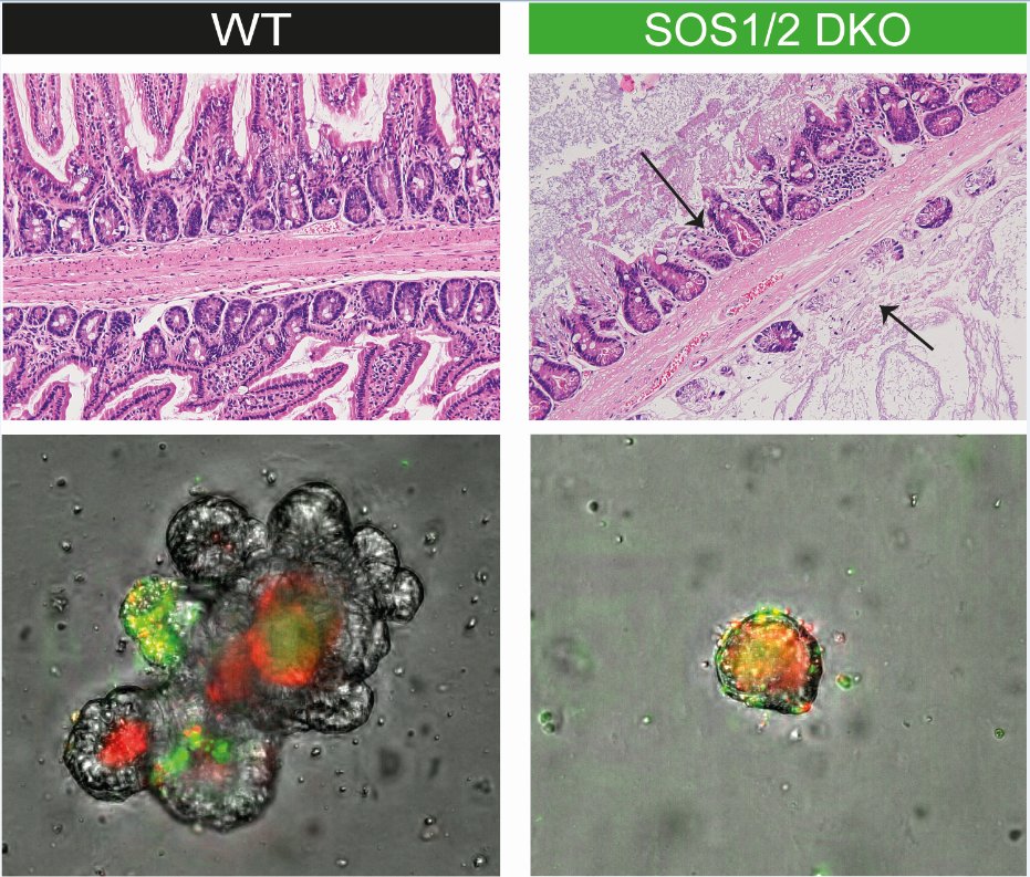 barrera intestinal