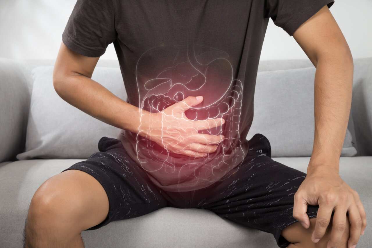 colon irritable